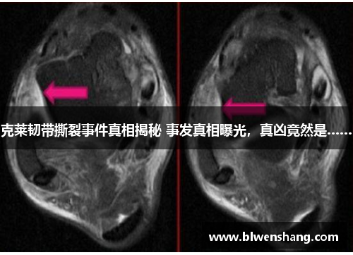 克莱韧带撕裂事件真相揭秘 事发真相曝光，真凶竟然是……
